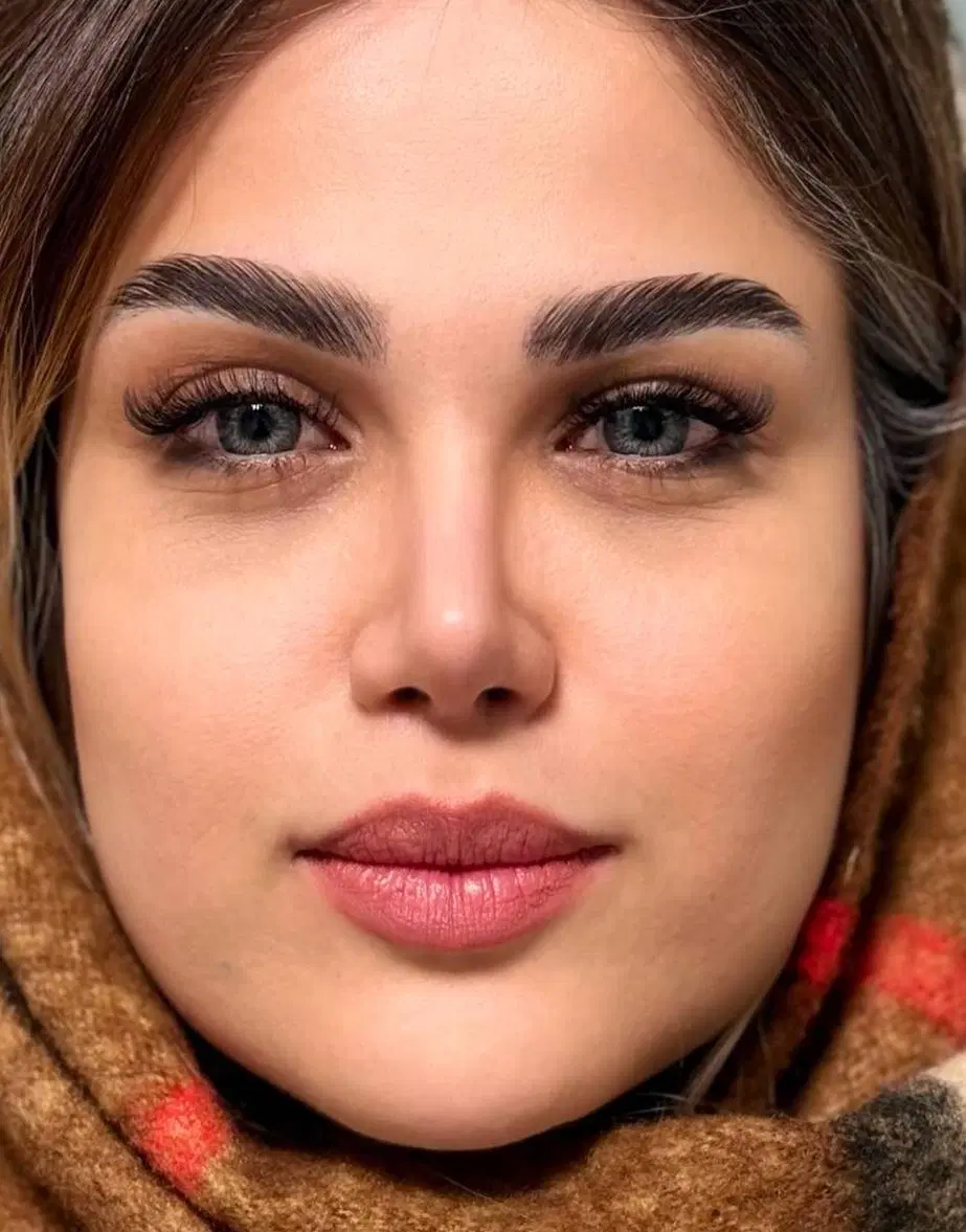 جراحی بینی باتخفیف 15تومن (تضمین پایین‌ترین قیمت) - تصویر 2