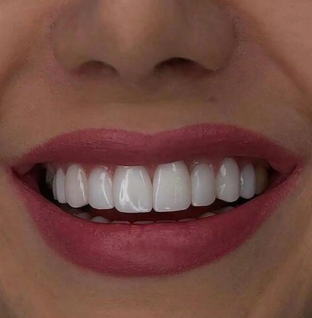 دندانپزشکی و دندان سازی خیریه چمران (جراحی. زیبایی - تصویر 10