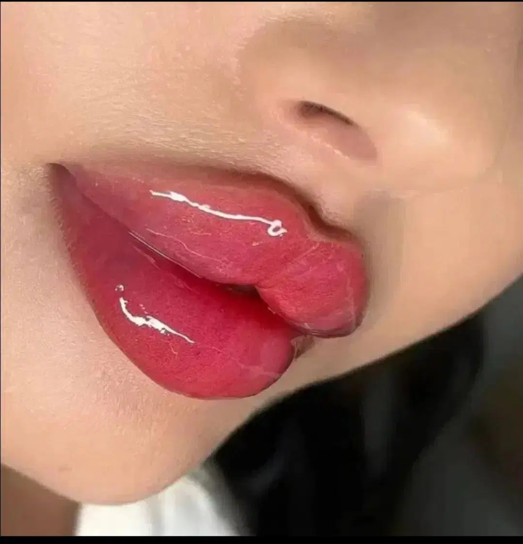 ژل650 و بوتاکس 900و پی ار پی - تصویر 10