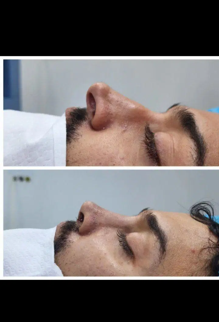 بندانگشتی 10