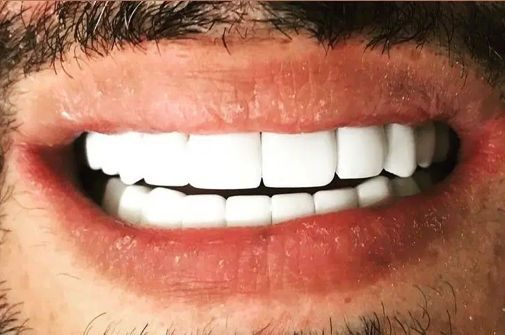 بندانگشتی 8